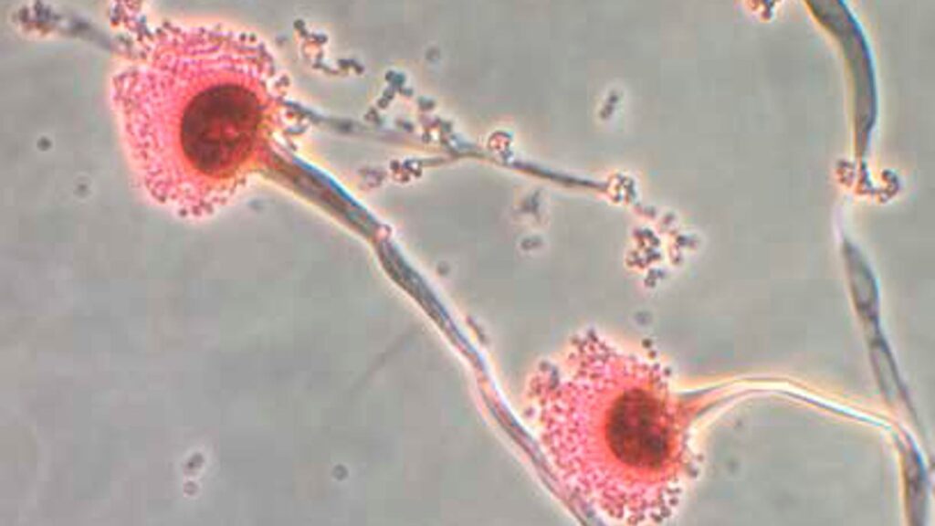Climate Change Fuels Rise Of Dangerous Bacteria In The Uk