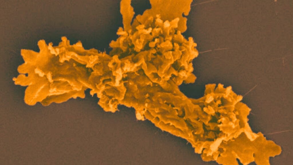 Revolutionary Fire Amoeba Sets New Heat Resistance Record Revolutionary Fire Amoeba Sets New Heat Resistance Record