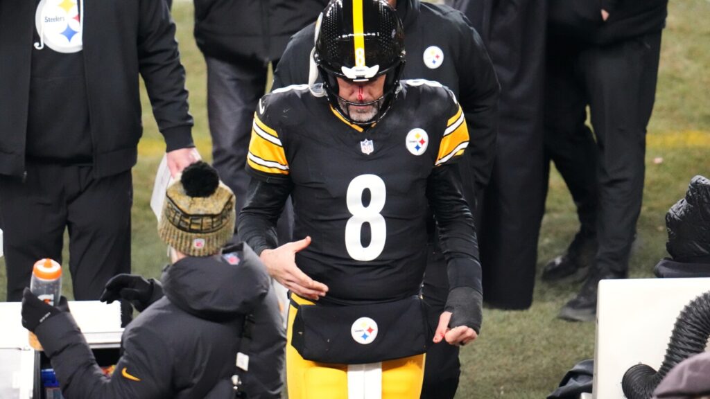 Rodgers Faces Nosebleed Woes as Steelers Struggle Offensively Rodgers Faces Nosebleed Woes As Steelers Struggle Offensively