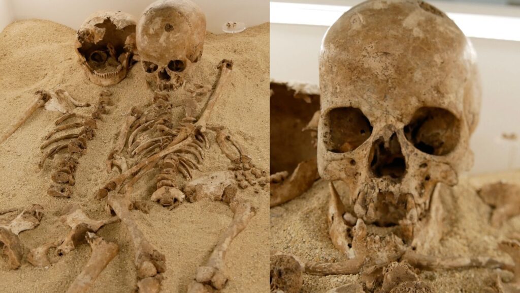 Ancient Italian Teenager Uncovers Secrets of Rare Dwarfism from 12,000 Years Ago Ancient Italian Teenager Uncovers Secrets Of Rare Dwarfism From 12,000